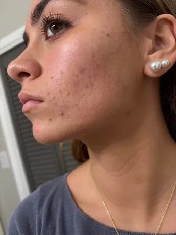 Mulher lidando com estresse